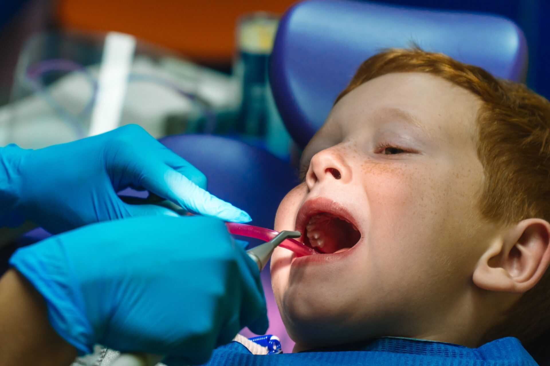 Small patient does not want to open the dentist's mouth on blue background. Dantist treats teeth. close up view of dentist treating teeth of little boy in dentist office.